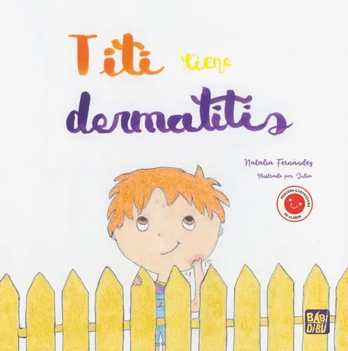 TITI  TIENE  DERMATITIS  